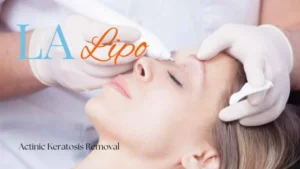 Woman receiving Actinic Keratosis Removal Treatment Leigh-on-Sea