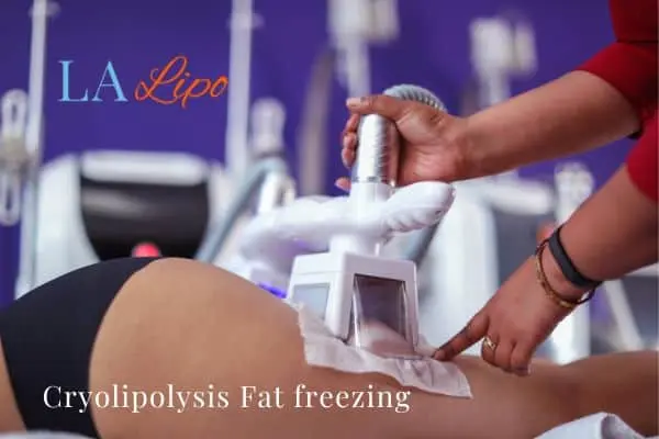 women getting fat freezing Leigh-on-Sea