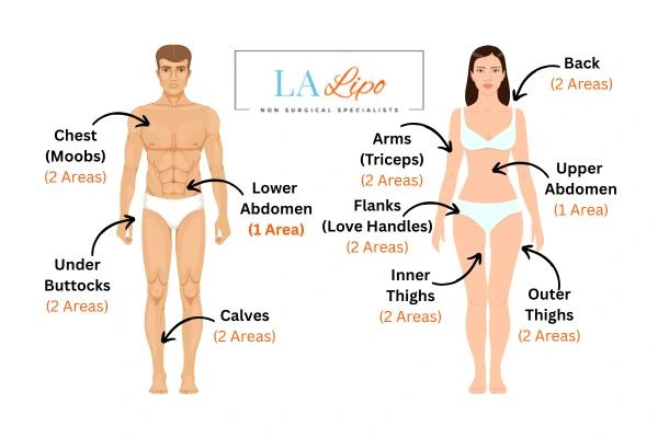 LA LIPO Cryolipolysis Areas Leigh-on-Sea