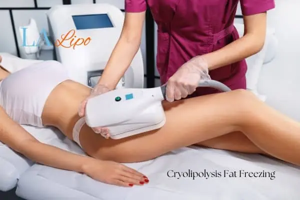Woman receiving coolsculpting Leigh-on-Sea treatment on her thighs