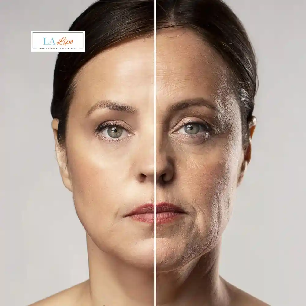 How Can You Tell If Non-Surgical Skin Tightening Is Right for You Leigh-on-Sea?