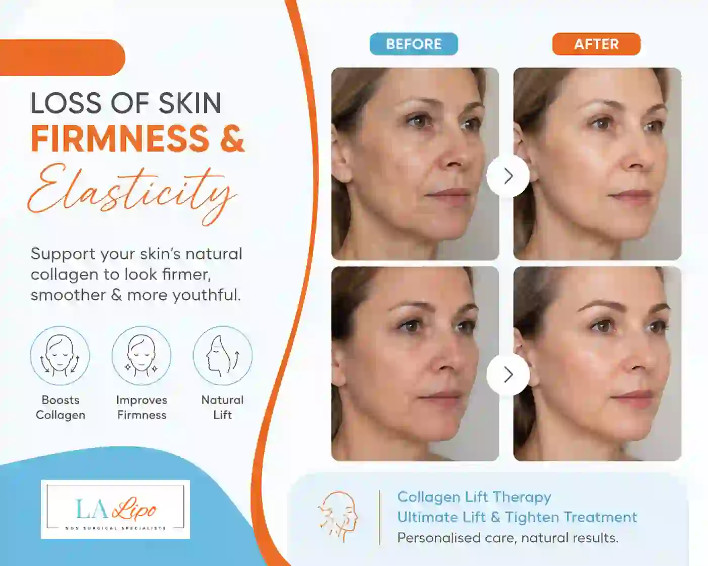 Sign #7: Loss of Skin Firmness and Elasticity Leigh-on-Sea
